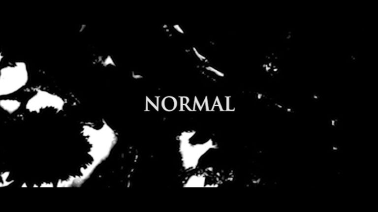 Normal01