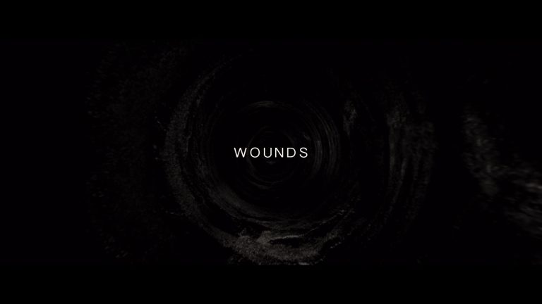 Wounds01