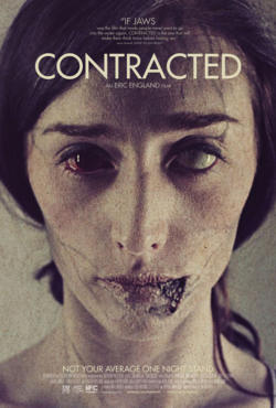 Contracted 1